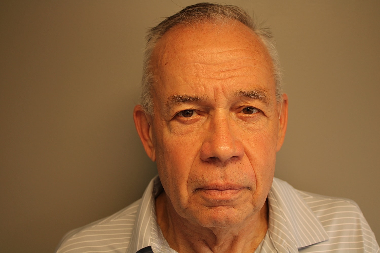 Blepharoplasty Before & After